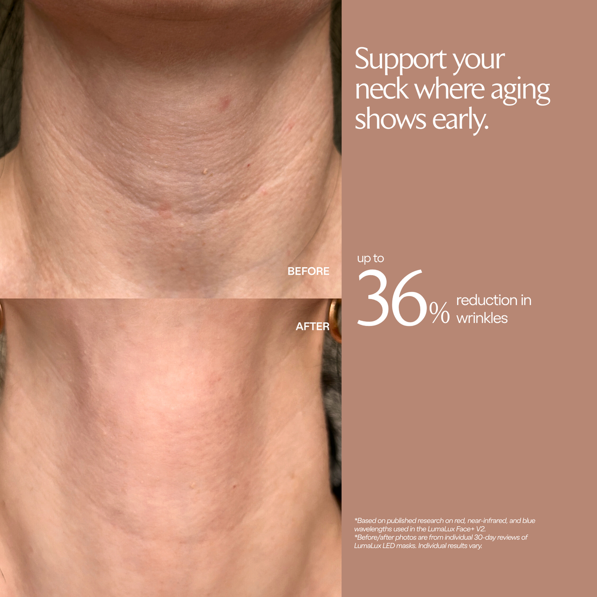 Testimonio LumaLux Face+ V2 con fotos del cuello de antes y después y un porcentaje de estudio