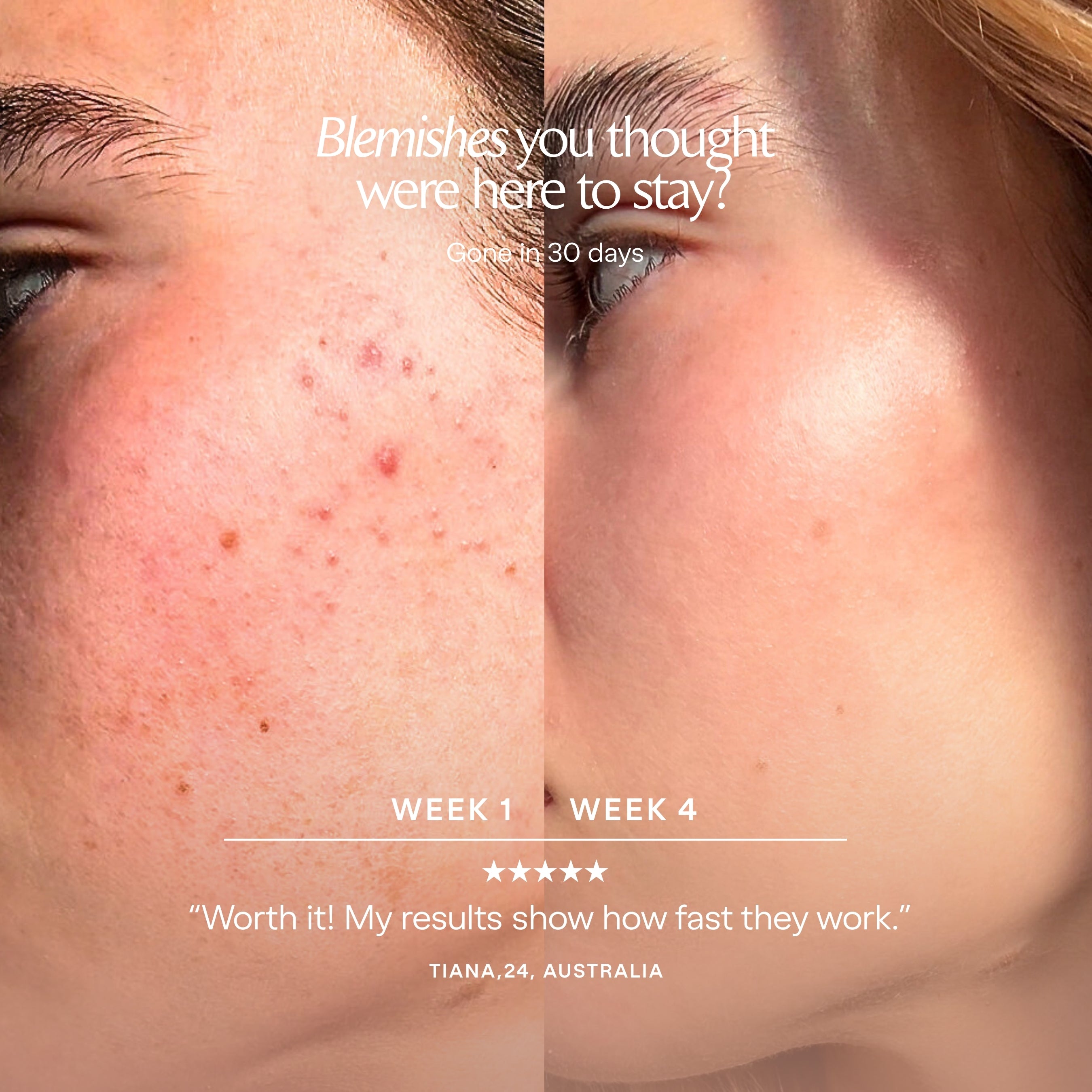 LumaLux Dome | Face & Body LED Red Light Therapy Device