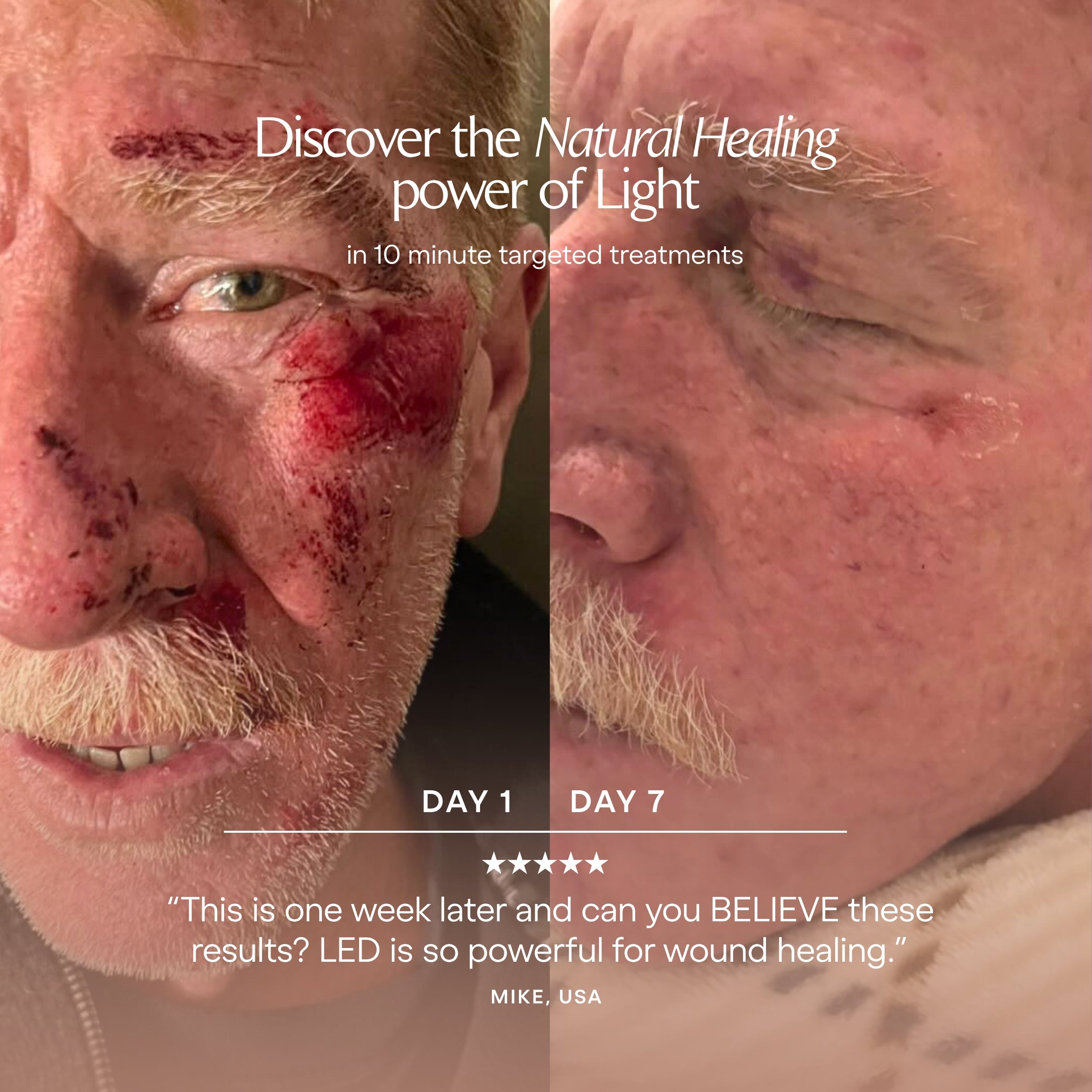 LumaLux Dome | Face & Body LED Red Light Therapy Device